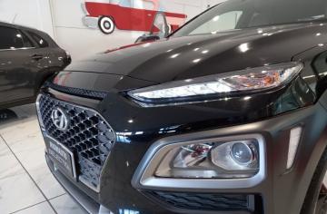 HYUNDAI - Kona 1.6 CRDI 115 CV Xpossible (25 di 27)